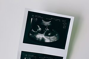Detailed close-up of a pregnancy ultrasound showing developing foetus.